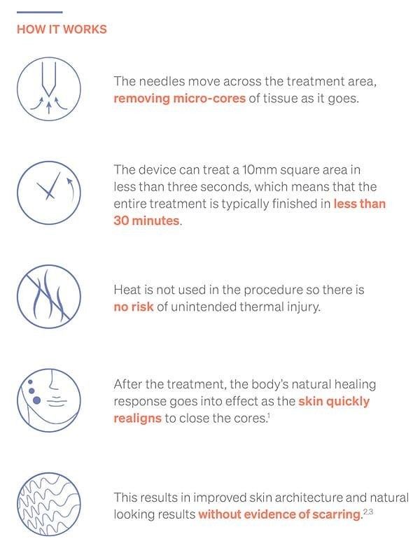 Skin treatment process and benefits overview.
