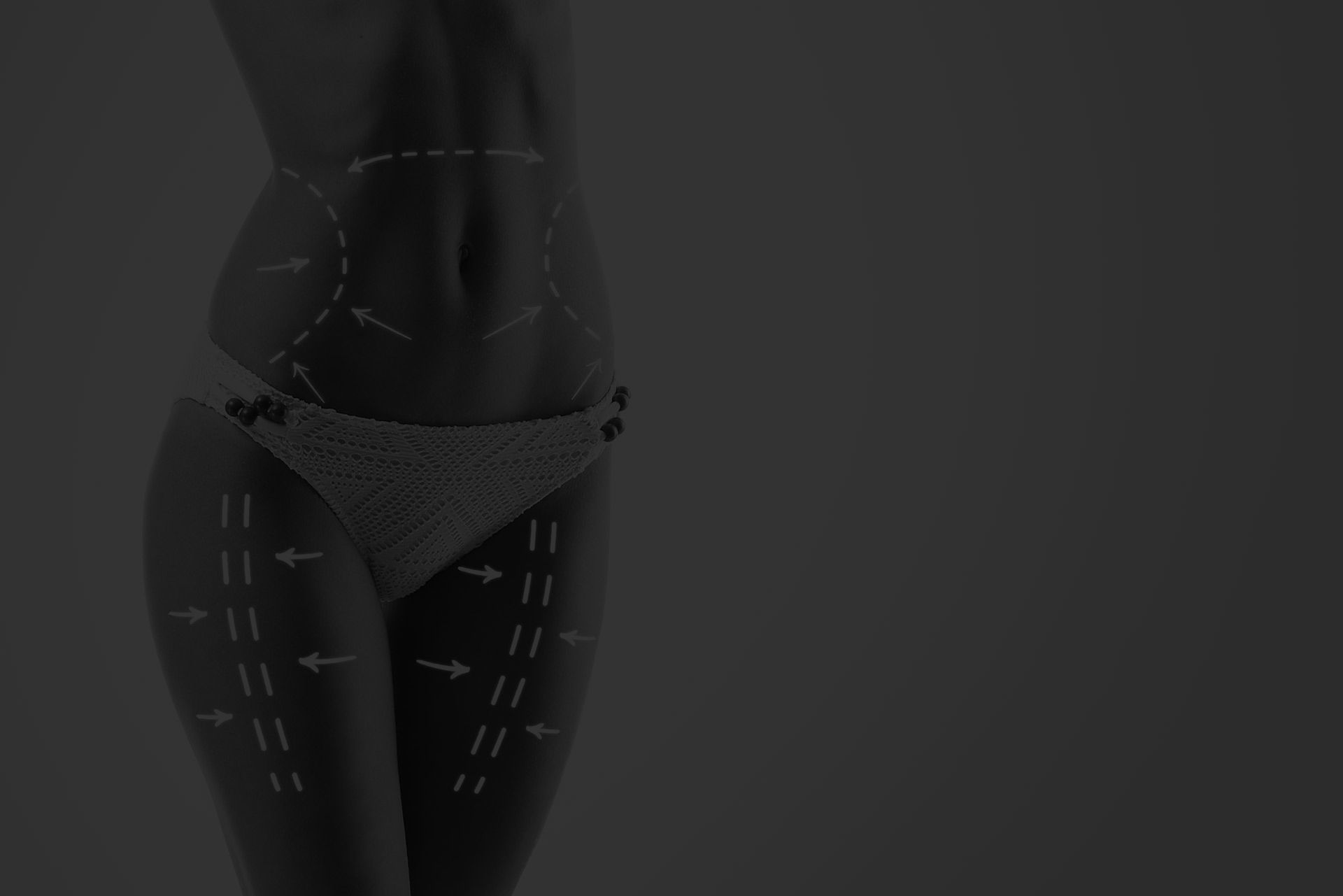 Body contouring lines on a woman's torso.