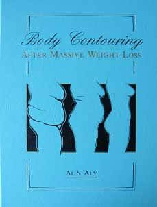 Aesthetic Surgery After Massive Weight Loss book cover