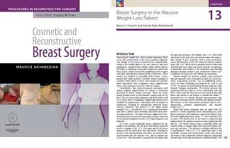 Aesthetic Surgery After Massive Weight Loss book cover