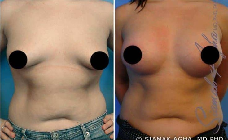 Before and after body transformation images.