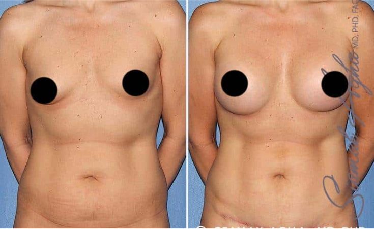 Before and after body transformation image.