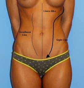 Diagram of body lines and anatomical references.