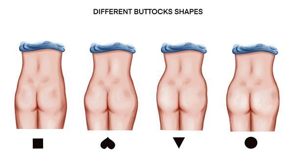 Illustration of various buttock shapes and styles.