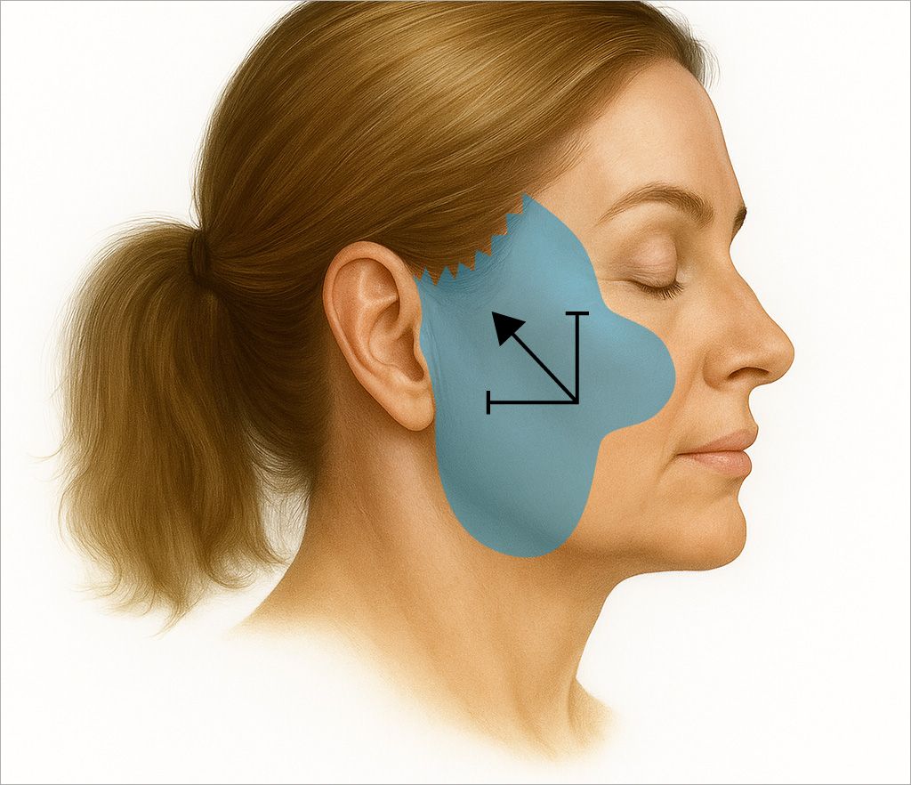 Illustration of facial anatomy with measurement indicators.