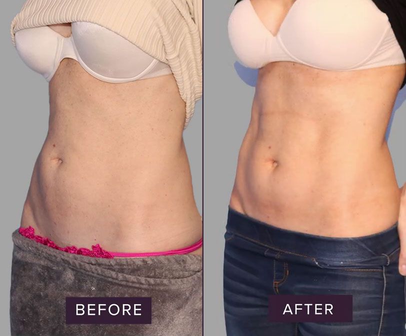 Body transformation before and after comparison.