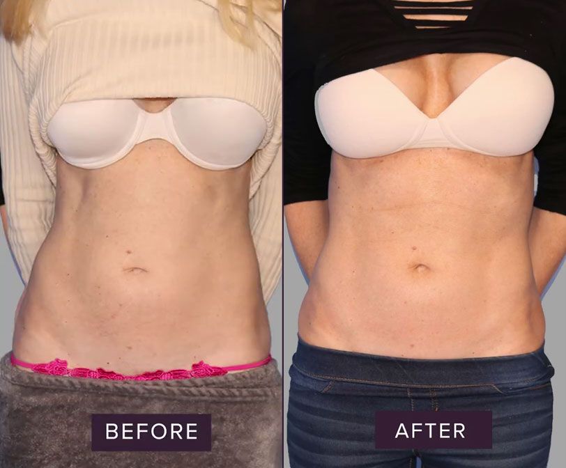 Before and after body transformation image.