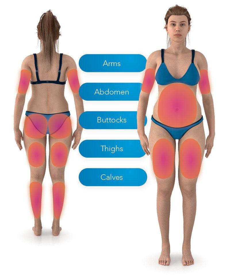 Body diagram highlighting key treatment areas.