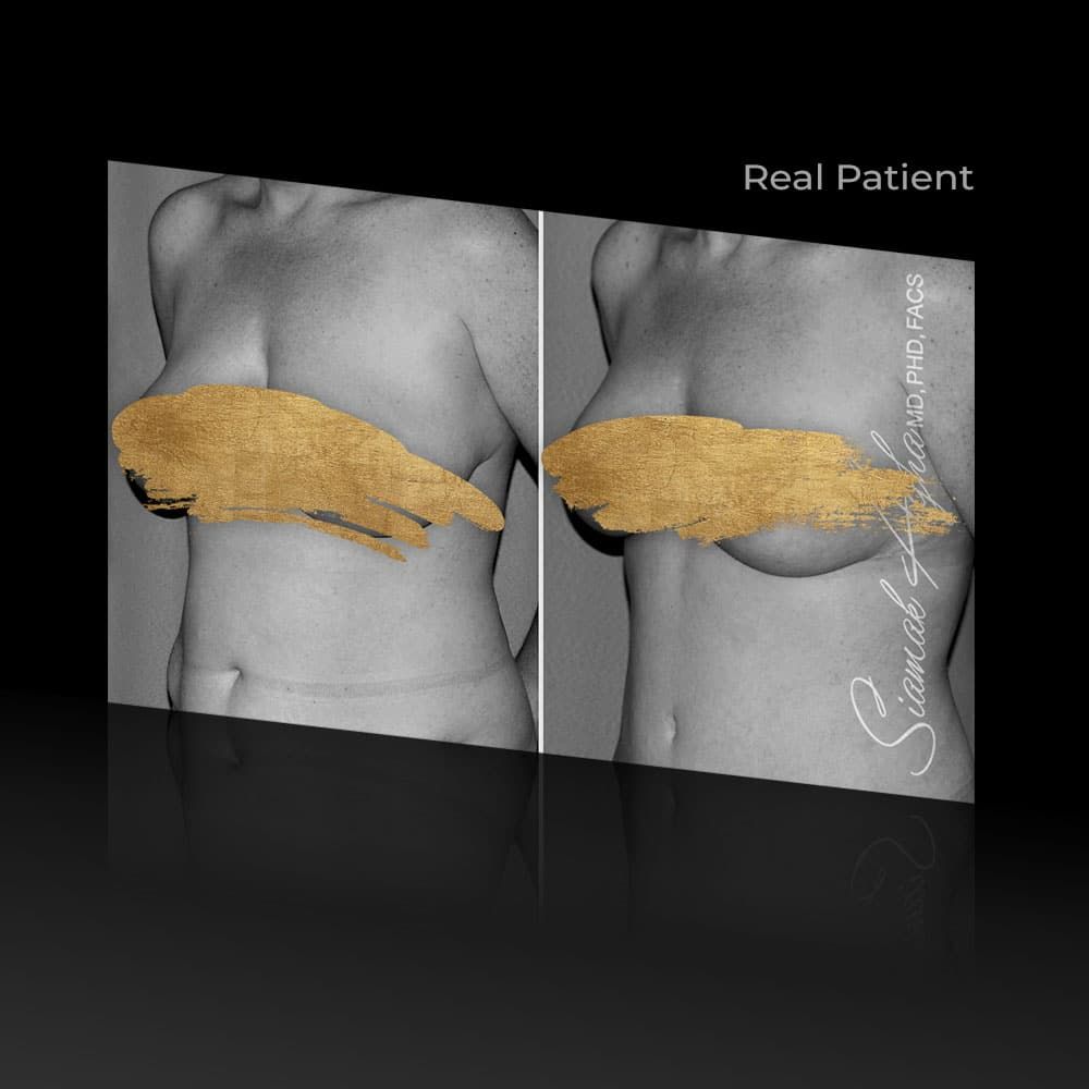 Before and after cosmetic procedure images.