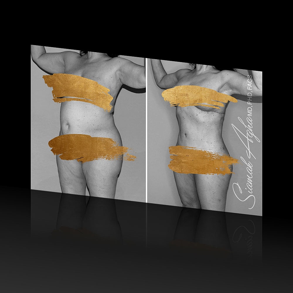 Dr Agha performing surgery in black and white.