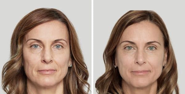 Comparison of two facial appearances side by side.