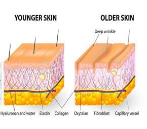 Comparison of younger and older skin textures.
