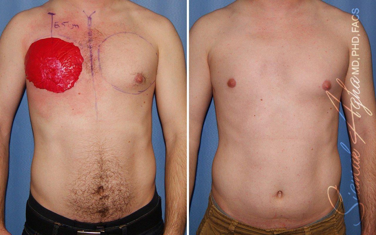 Reconstructive Gallery Before & After