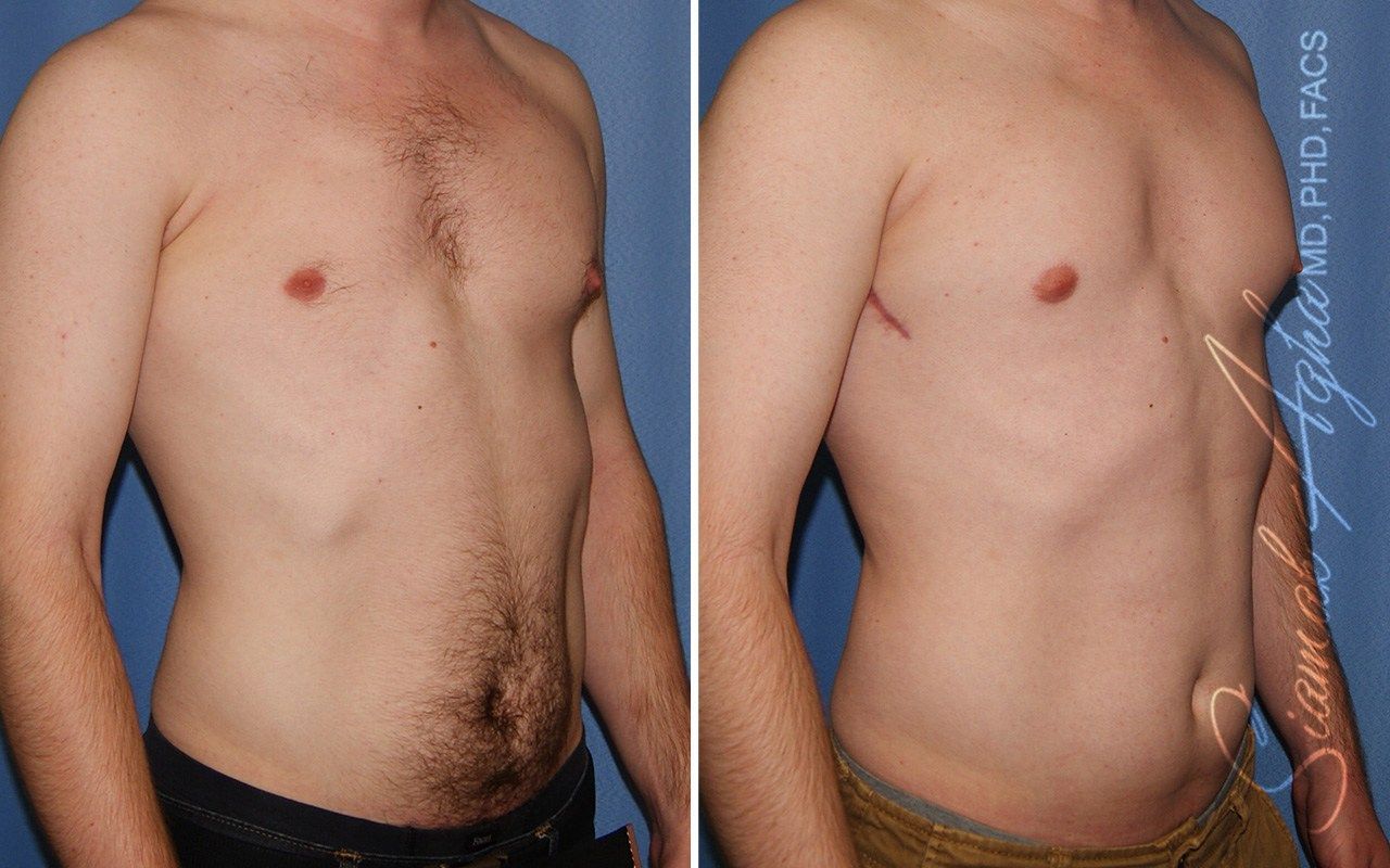 Reconstructive Gallery Before & After