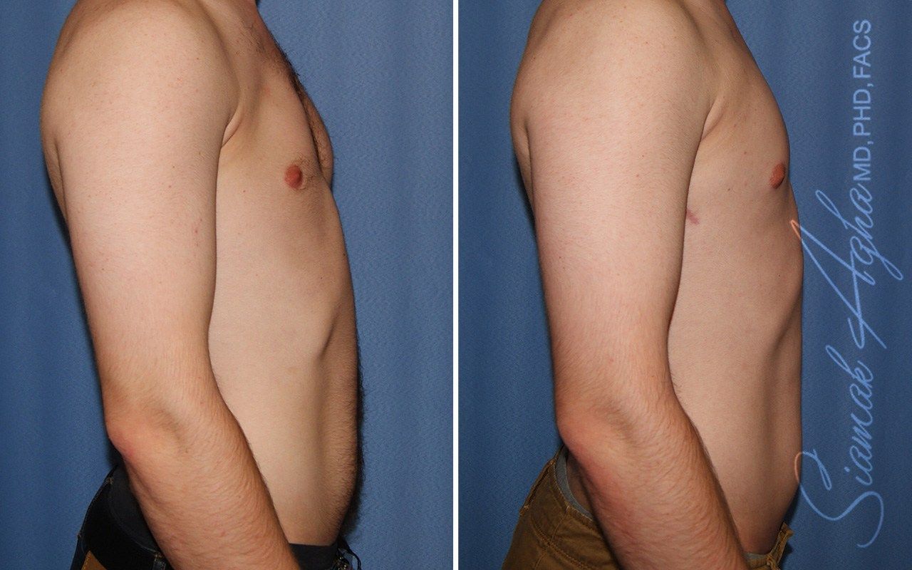 Reconstructive Gallery Before & After