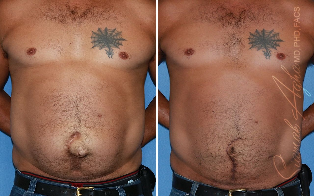 Reconstructive Gallery Before & After