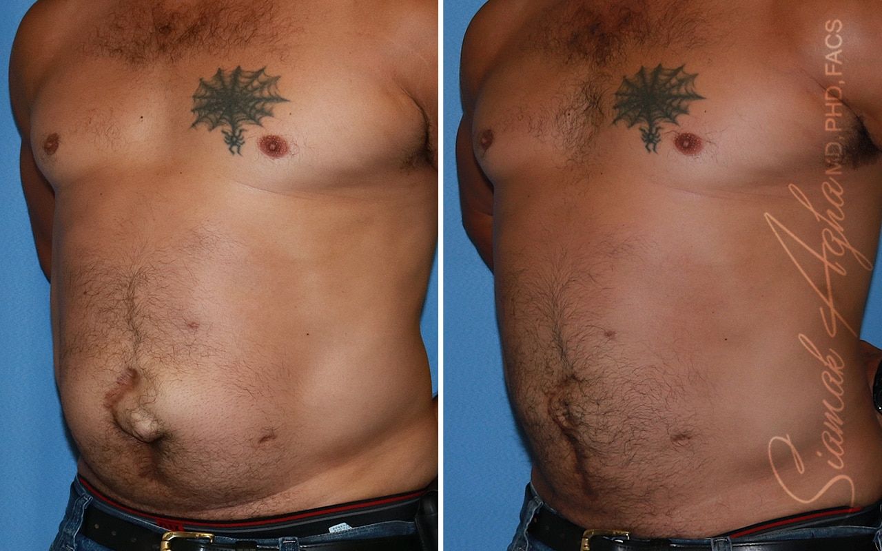 Reconstructive Gallery Before & After