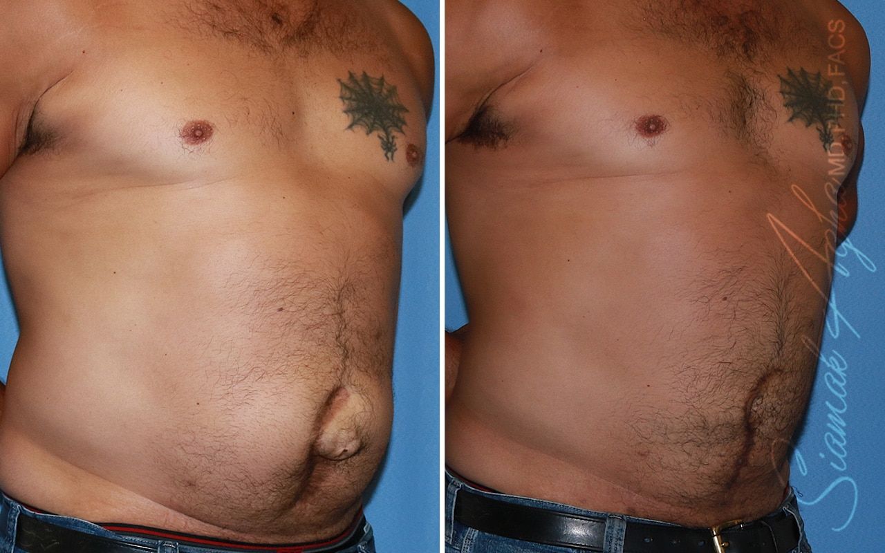 Reconstructive Gallery Before & After