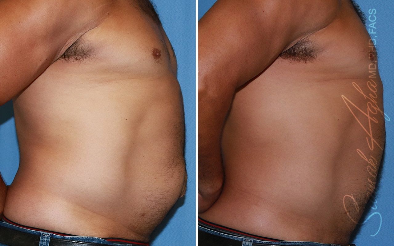 Reconstructive Gallery Before & After