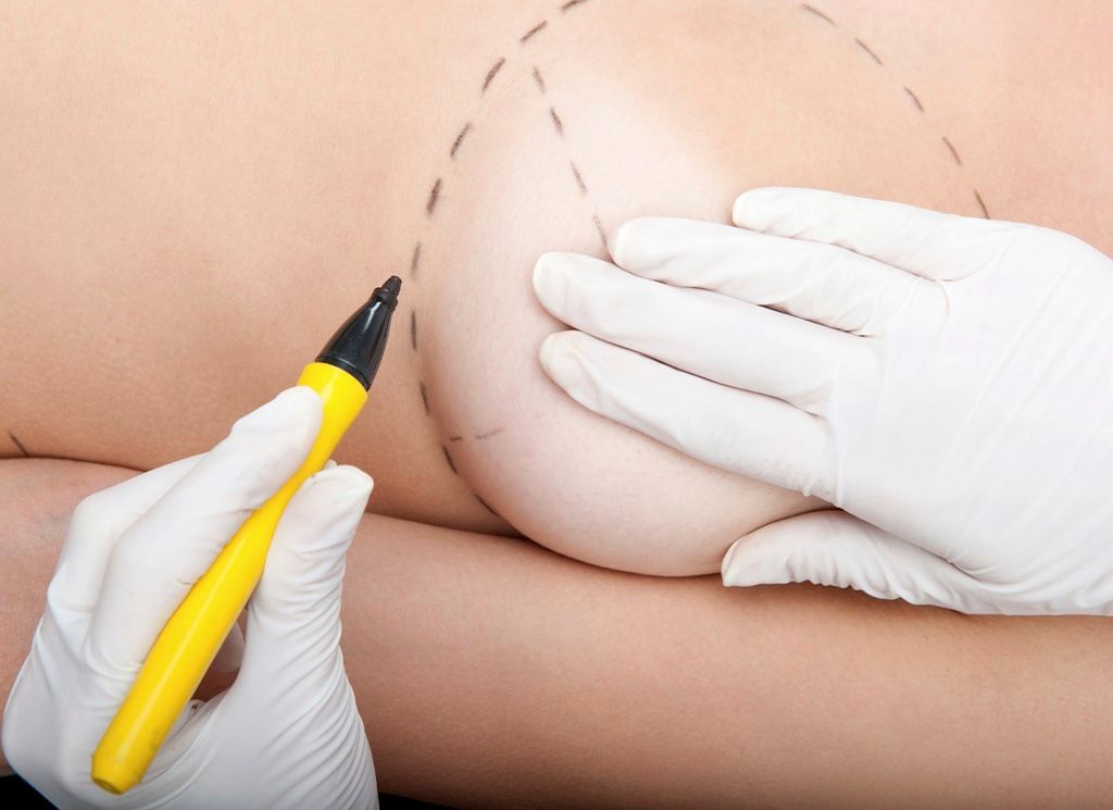 What Are The Safest Plastic Surgery Options? Newport Beach, CA