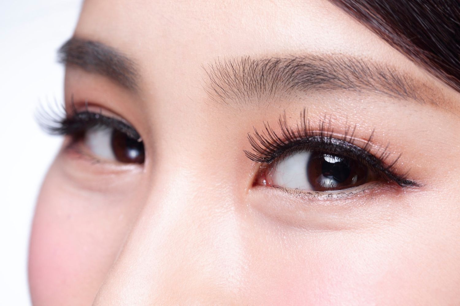 Asian Blepharoplasty Newport Beach, CA