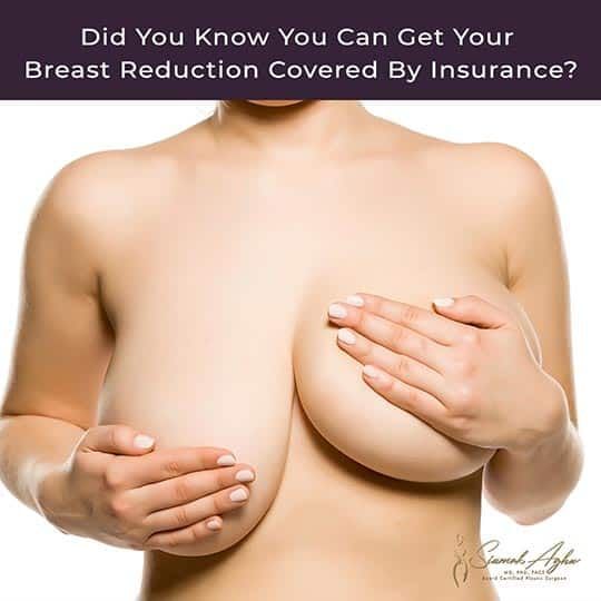 Did You Know that You Can Get Your Breast Reduction Covered by Insurance?