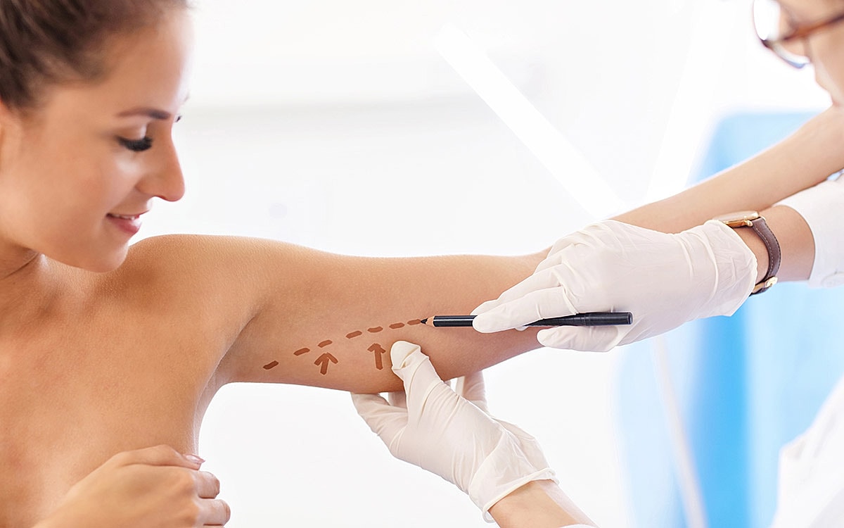 Patient receiving markings for a medical procedure.