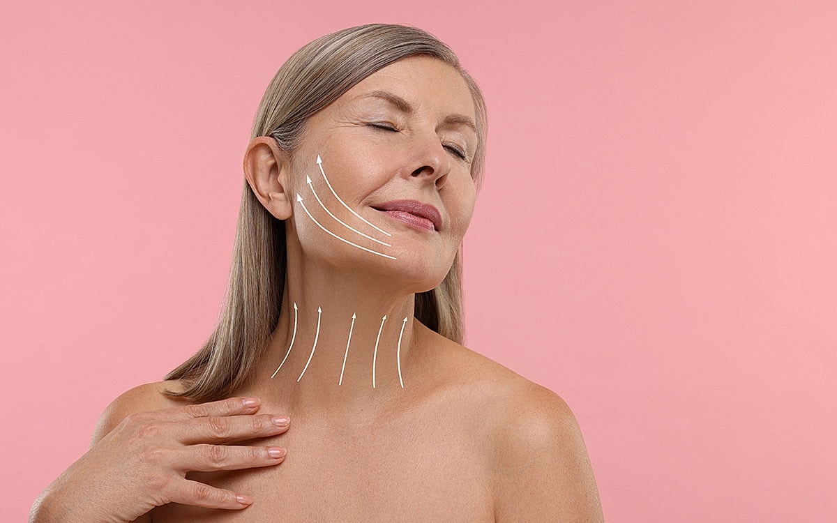 Facial lifting treatment illustration on a woman.