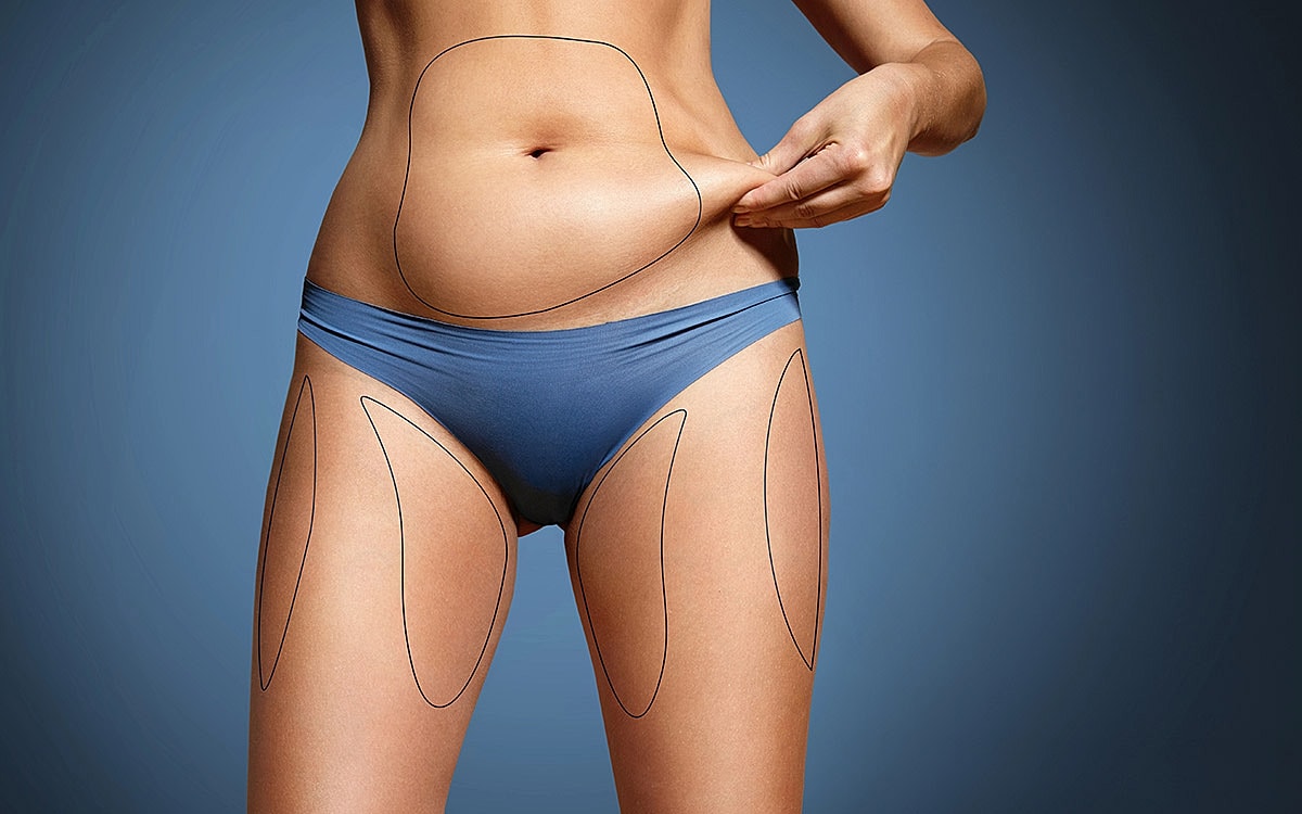 Body contouring illustration on female abdomen and thighs.