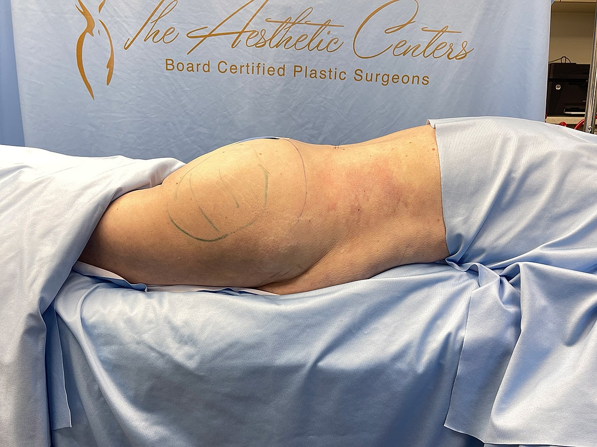 Surgical preparation on patient’s side in clinic.