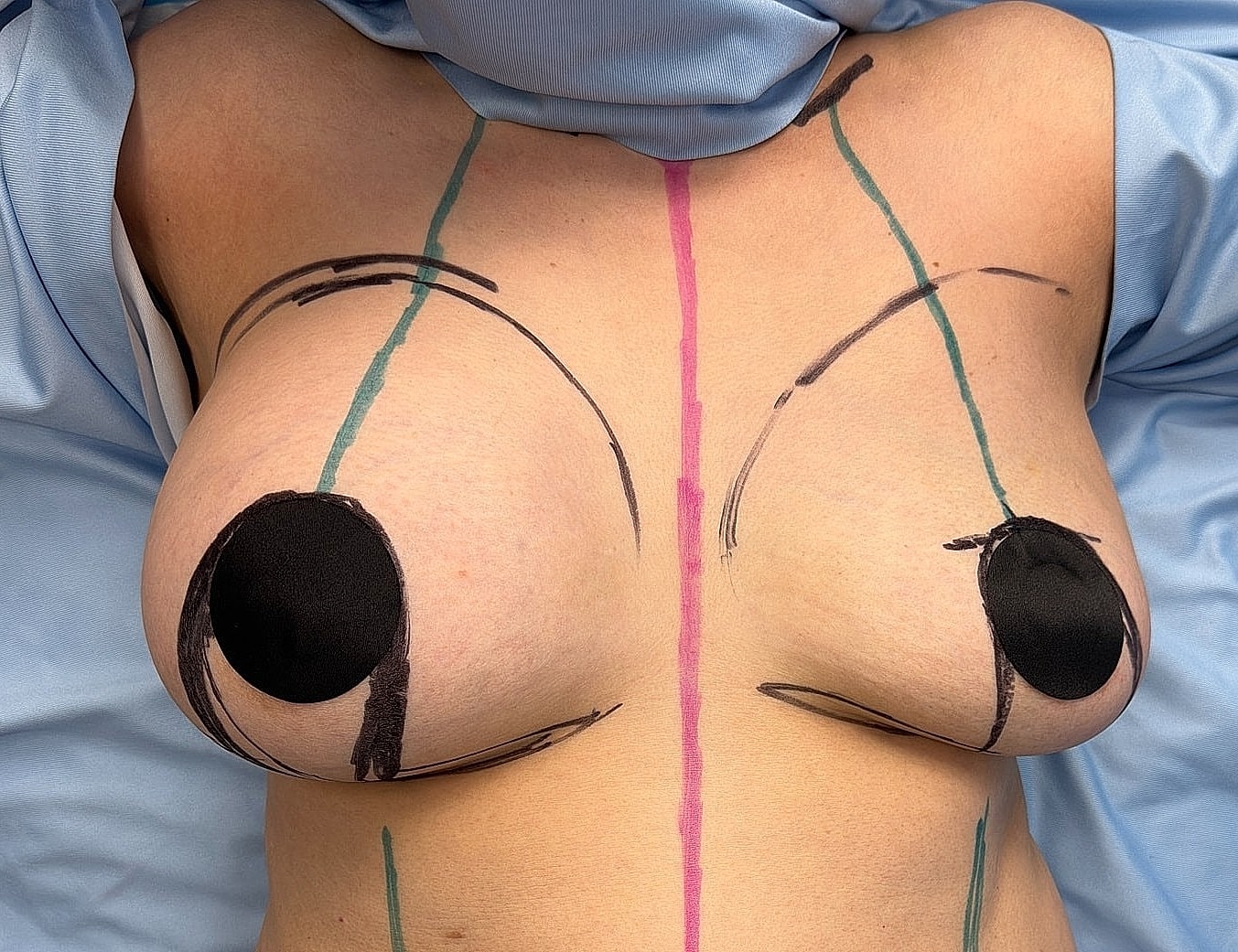 Body art with markings on a bare torso.