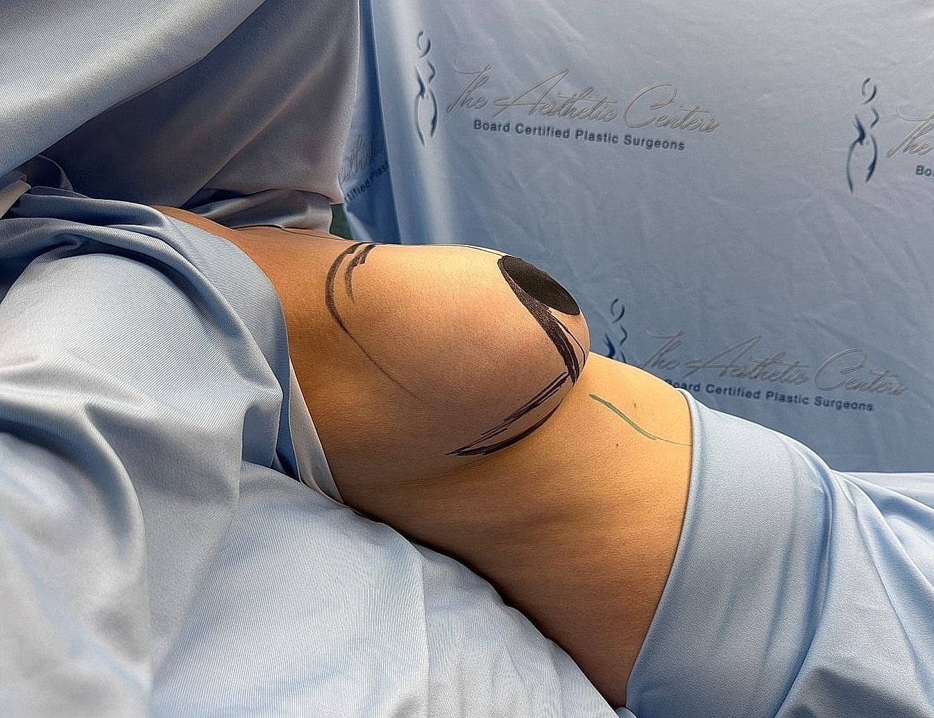 Patient preparation in a surgical setting.
