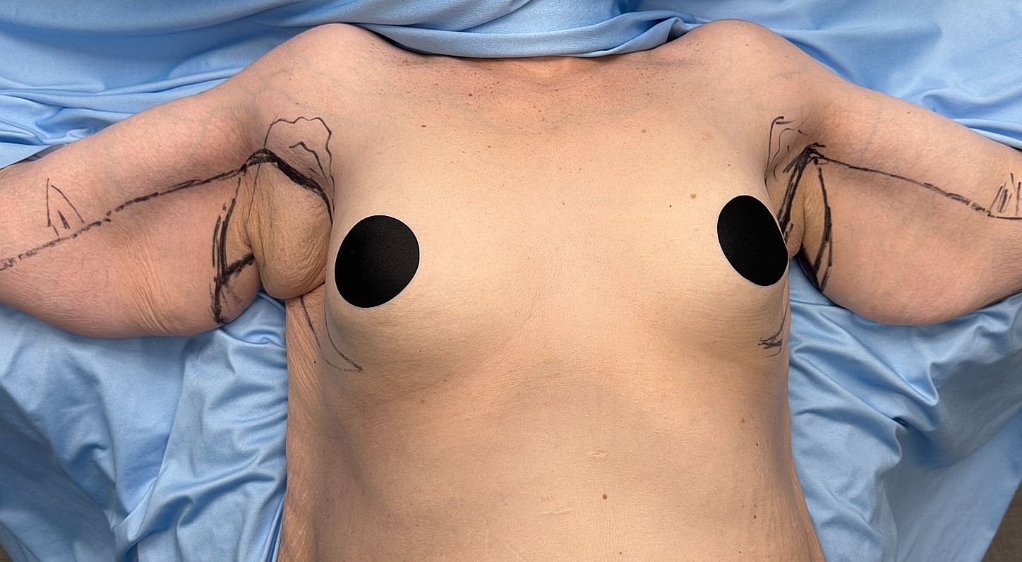 Body with artistic markings under a blue drape.