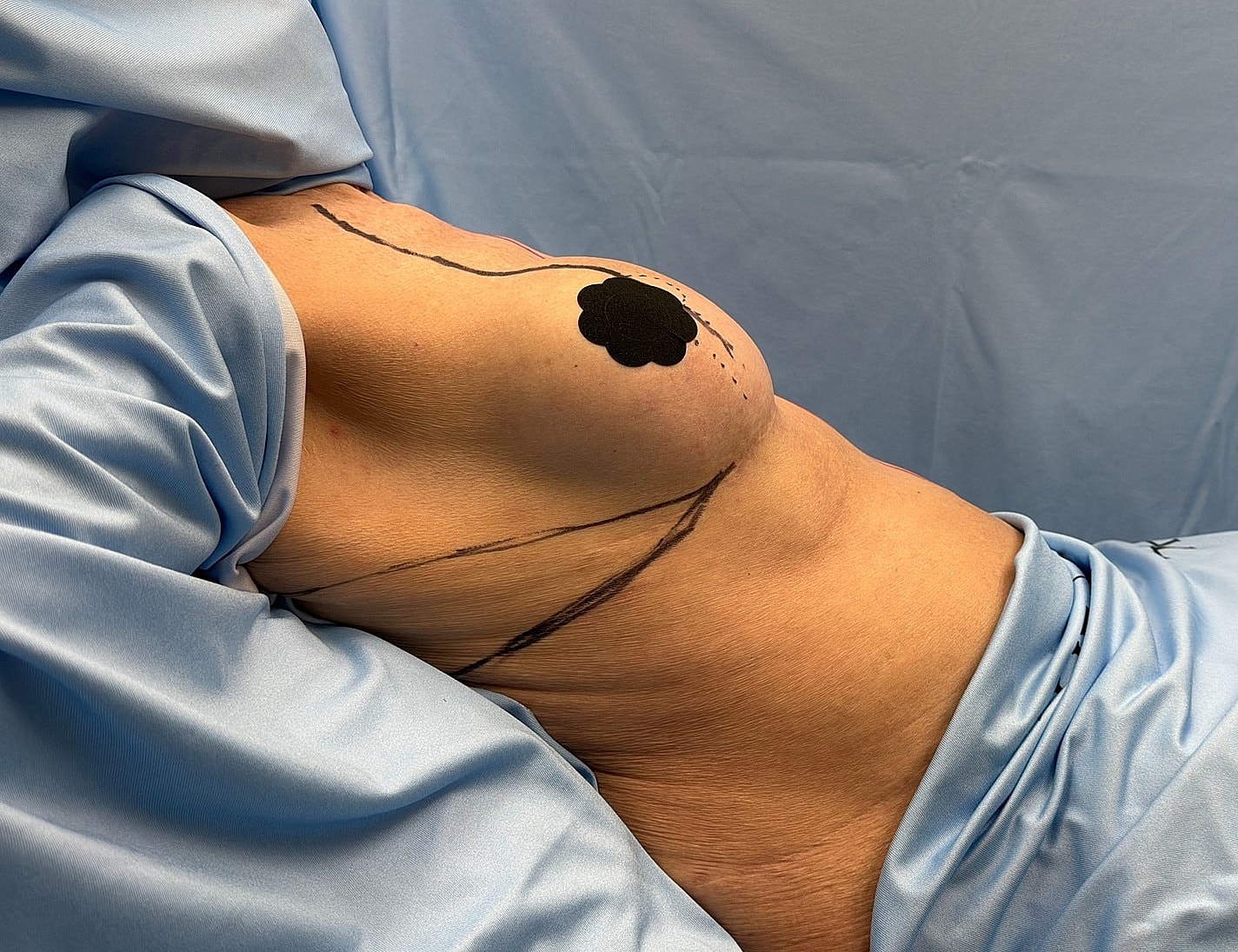 Body art on a torso with blue fabric.