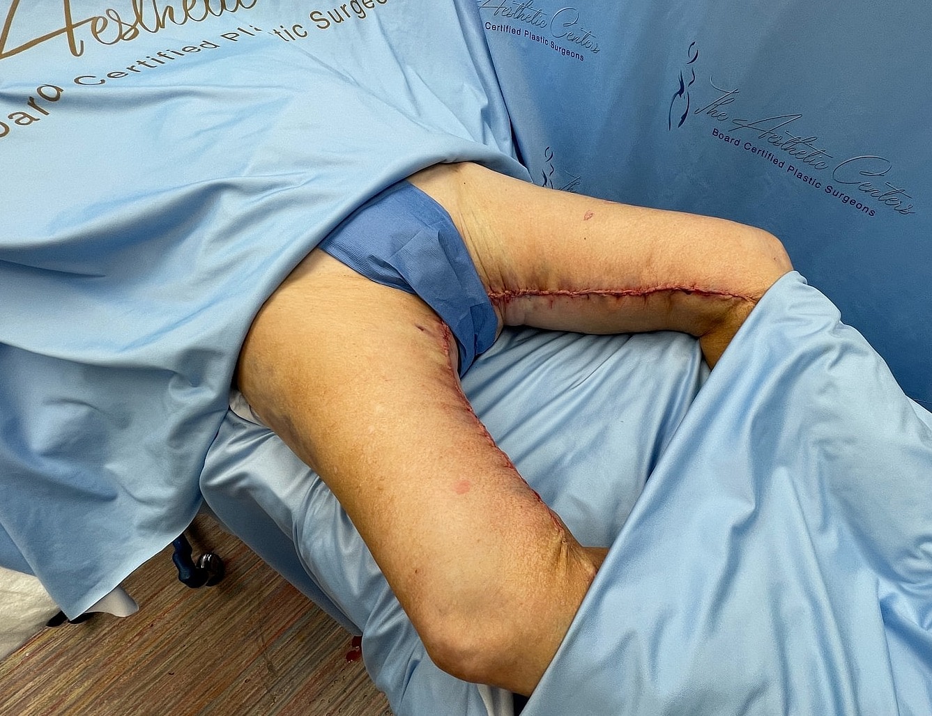 Post-surgery recovery at a plastic surgery center.