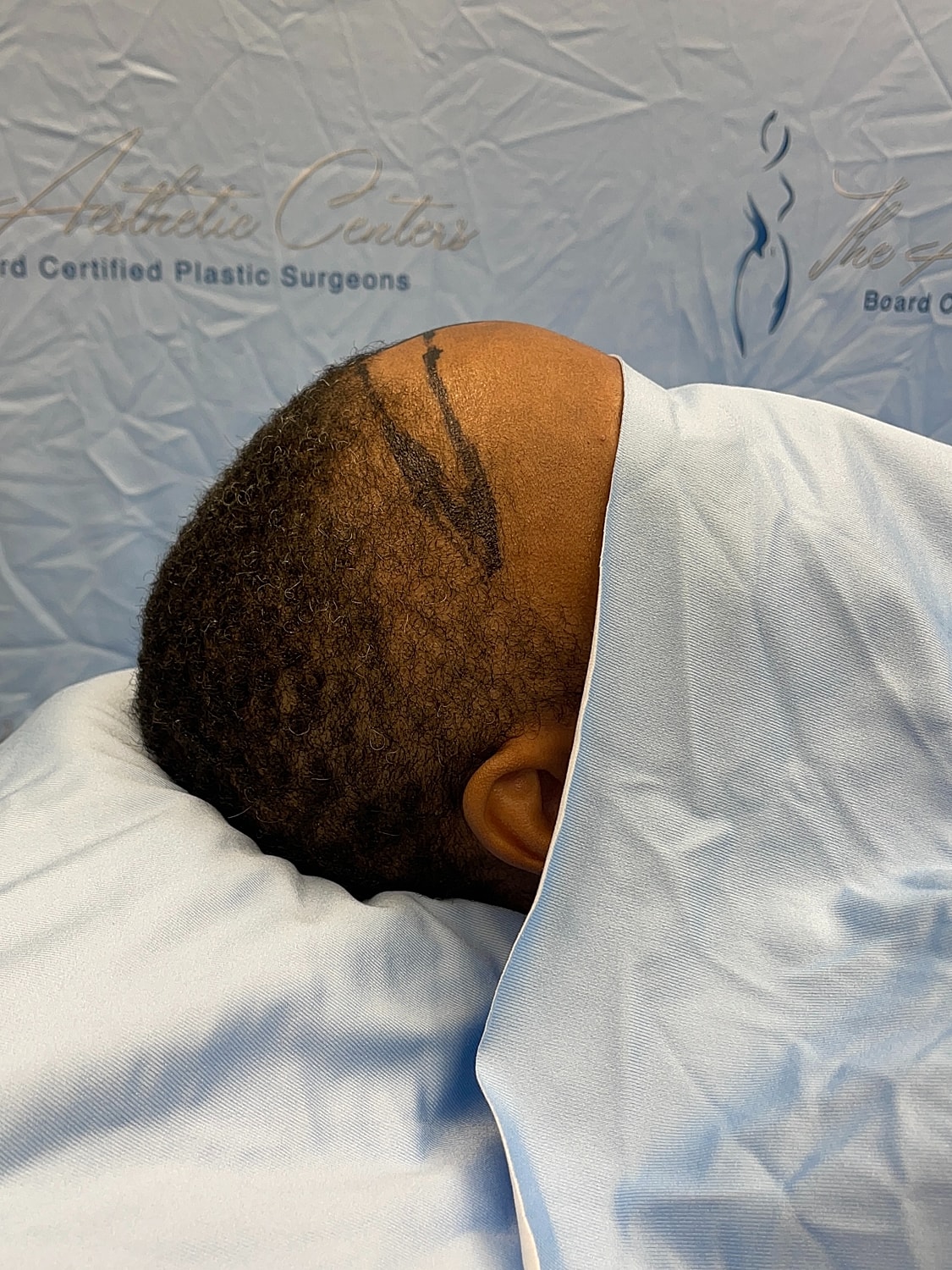 Patient preparing for a surgical procedure.
