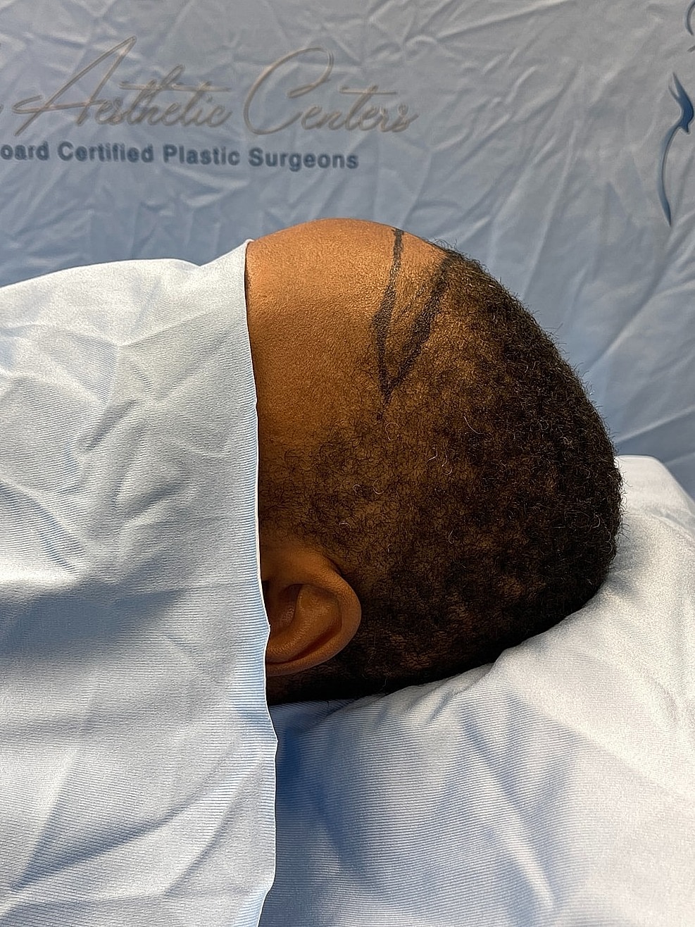 Patient preparing for a surgical procedure.